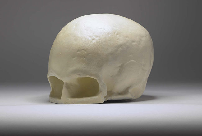 Plaster-cast-of-the-skull-of-Robert-Burns