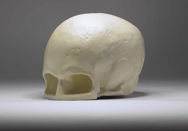 Plaster-cast-of-the-skull-of-Robert-Burns